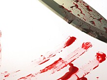 В ЦВО рассказали о состоянии солдат, пострадавших в массовой драке