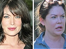 Из красавицы в жертву пластики: как звезда «Твин Пикс» Лара Флинн Бойл лишилась карьеры