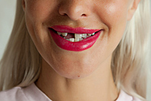 Женщина не попала к стоматологу и вырвала себе 11 зубов