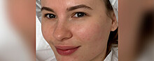 Звезда «Мажора» Анна Цуканова-Котт поделилась фото без макияжа