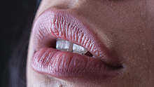 Названы заболевания, на которые может указывать сухость губ