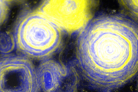 NatComms: разработаны антитела, обнаруживающие листерии в состоянии спячки