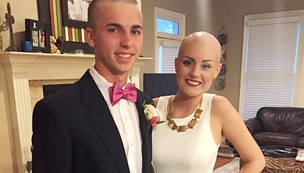 Подросток обрил голову в знак солидарности со своей больной раком подружкой