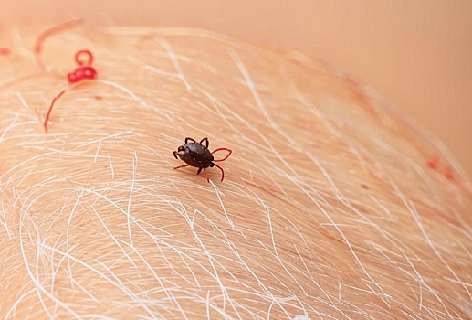 Врач Мясников заявил, что при укусе клеща нужно сразу принимать антибиотики