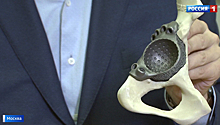 Прочнее стали: в Боткинской больнице кости и суставы из титана печатают на 3D-принтере