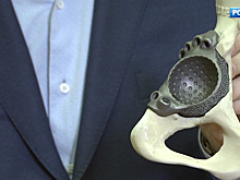 Прочнее стали: в Боткинской больнице кости и суставы из титана печатают на 3D-принтере