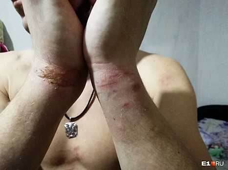 «На голову надели пакет и стали бить»: тагильчанин оказался в травмпункте после допроса в полиции
