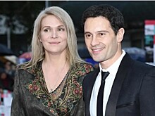 Поклонники встревожены внешним видом Макарской