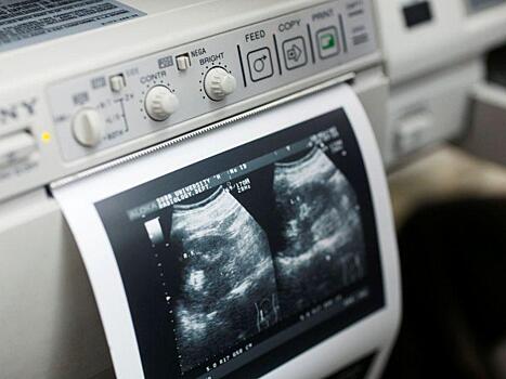 Аномалии клеток и рак будут искать за счет звуковых волн