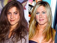 Звездная ринопластика, с которой (не) стоит брать пример