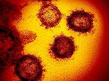 Доказана опасность бессимптомных носителей COVID-19