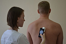 Уральские ученые создали мобильное приложение для ранней диагностики рака кожи