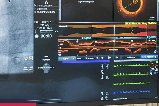 Новоуренгойские врачи освоили новый метод диагностики болезней сердца
