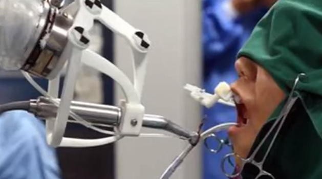 Китайский робот‐стоматолог впервые прооперировал человека
