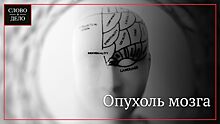 Врач перечислил изменения зрения, указывающие на возможную опухоль мозга