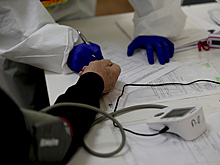 Названы семь возможных видов сыпи при коронавирусе