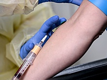 Врачи назвали пять признаков повышенного холестерина