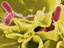 Российские туристы заразились сальмонеллезом в ОАЭ