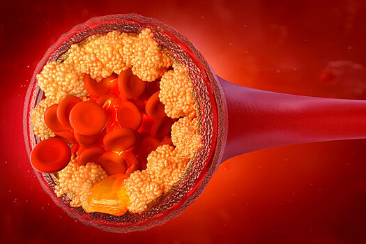 Развеян популярный миф о побочных эффектах статинов