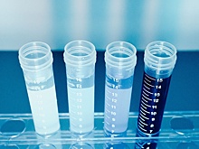 Президент WADA заявил об окончании допинговой истории в РФ