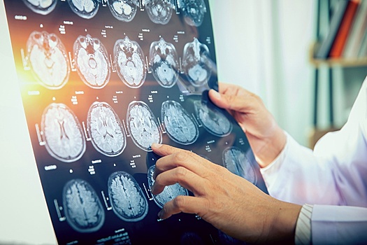 Ученые утверждают: стрессы ухудшают энергоснабжение мозга