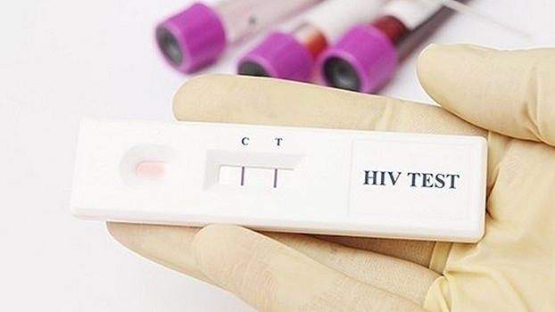 11 жителей Вологды узнали о положительном ВИЧ-статусе в этом году