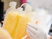 Методику омоложения пениса одержимого молодостью миллиардера оценили врачи