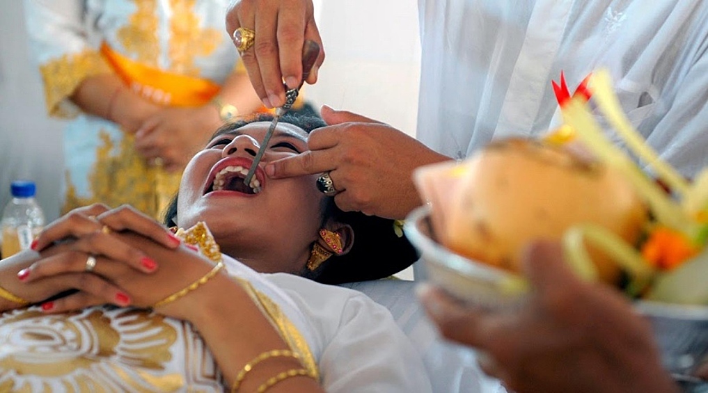Спиливание зубов. Эта традиция является одной из самых значимых для тех, кто исповедует индуизм. Спиливание зубов у повзрослевших женщин и мужчин обозначает избавление от зла и похоти.