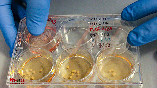 В лаборатории вырастили мини-мозги неандертальцев