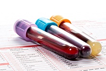 Депздрав рекомендует ежегодно сдавать общий анализ крови
