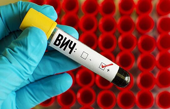 В Екатеринбурге 14 февраля пройдет акция бесплатного тестирования на ВИЧ