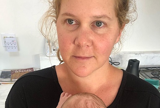 Стесняться нечего: Эми Шумер впервые показала шрам от кесарева сечения