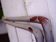 Кемеровчанин оказался в больнице после кровавого вечера с девушкой