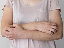 Врач перечислила причины появления атопического дерматита