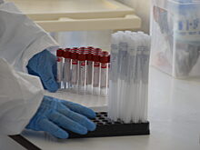 За последние сутки COVID-19 выявили в 37 муниципалитетах Кубани