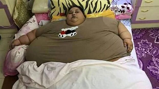 Самая тучная женщина планеты сбросила 140 кг