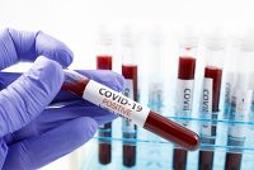 Первая партия вакцины от COVID-19 направлена в регионы