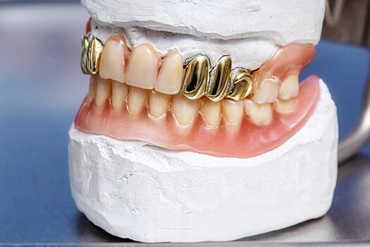 Главный стоматолог Минздрава РФ рекомендовал отказаться от установки золотых коронок