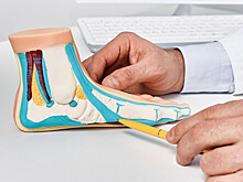 Можно ли предотвратить развитие плоскостопия с помощью обуви