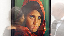 "Афганскую девочку" бесплатно вылечат в Индии