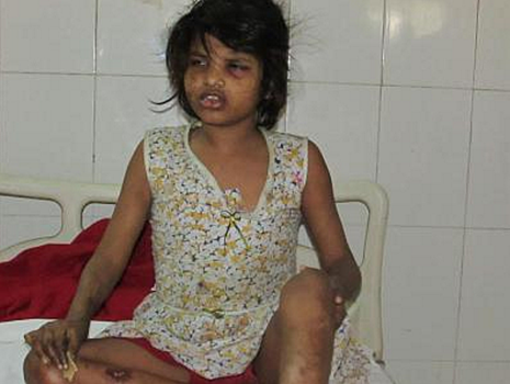 В Индии обнаружили 8-летнюю девочку-маугли