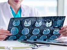 Ученые раскрыли, как радиоактивная фруктоза помогает при диагностике рака