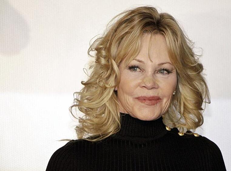 От той же болезни, что и Хью Джекман, страдала голливудская дива Мелани Гриффит. Впервые опухоль на лице актрисе удалили в 2009 году. 