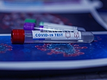 Тест на антитела к коронавирусу предложили включить в ОМС