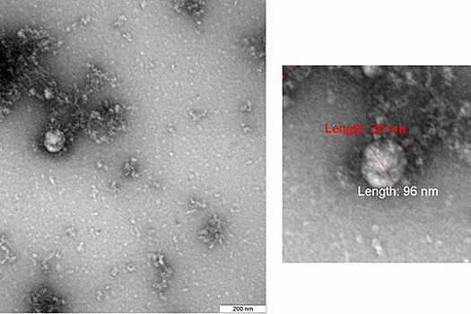 В РФ зарегистрировали тест-систему для определения "британского" штамма COVID-19