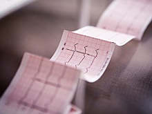 Врач назвала симптом, который предшествует внезапной смерти: "Вчера еще был здоров"