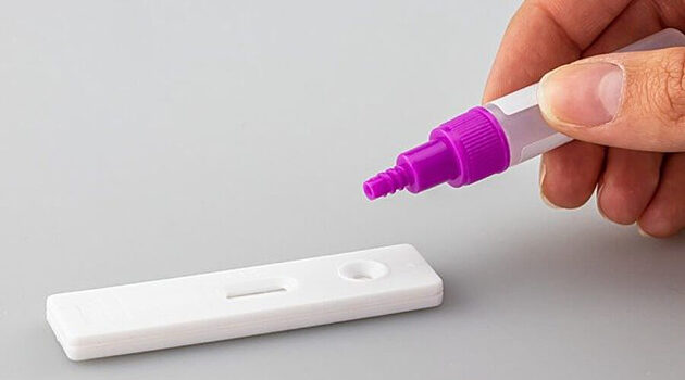 Генпрокуратура проверит появившиуюся в СМИ информацию о резком подорожании ПЦР-тестов