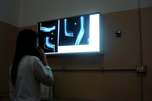 Более 13 тыс исследований провели на новом рентгенаппарате в больнице Орехово‑Зуева