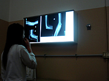 Более 13 тыс исследований провели на новом рентгенаппарате в больнице Орехово‑Зуева