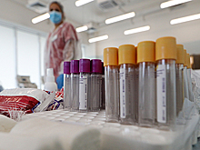 Учёный назвал условия и сроки прекращения пандемии COVID-19